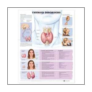  Thyroid Disorders Anatomical Chart 20 X 26 Laminated 