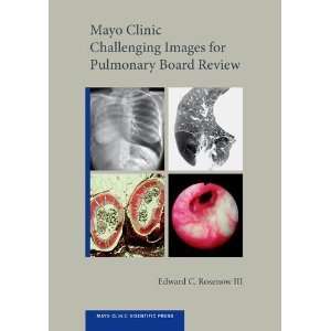 Mayo Clinic Challenging Images for Pulmonary Board Review (Mayo Clinic 